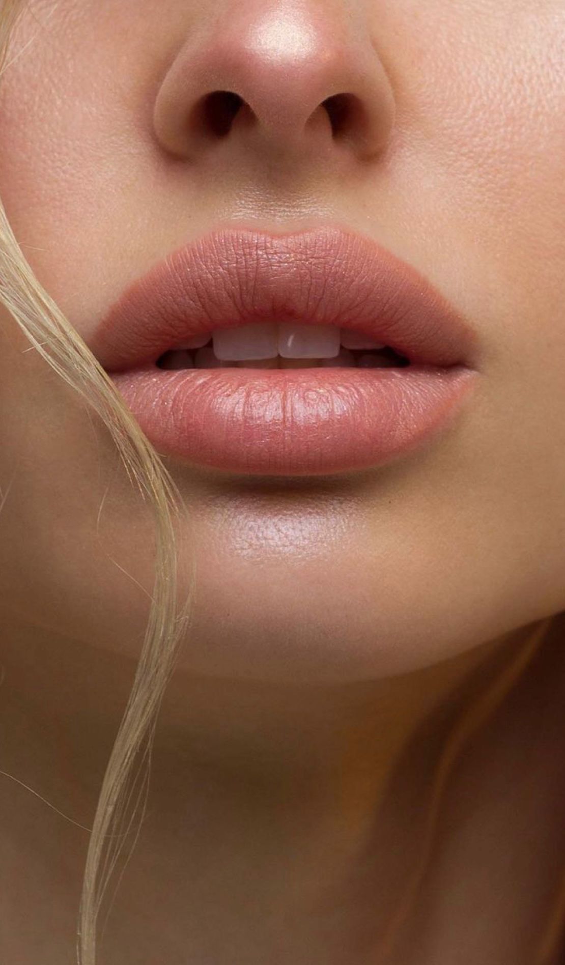 Dermal Filler