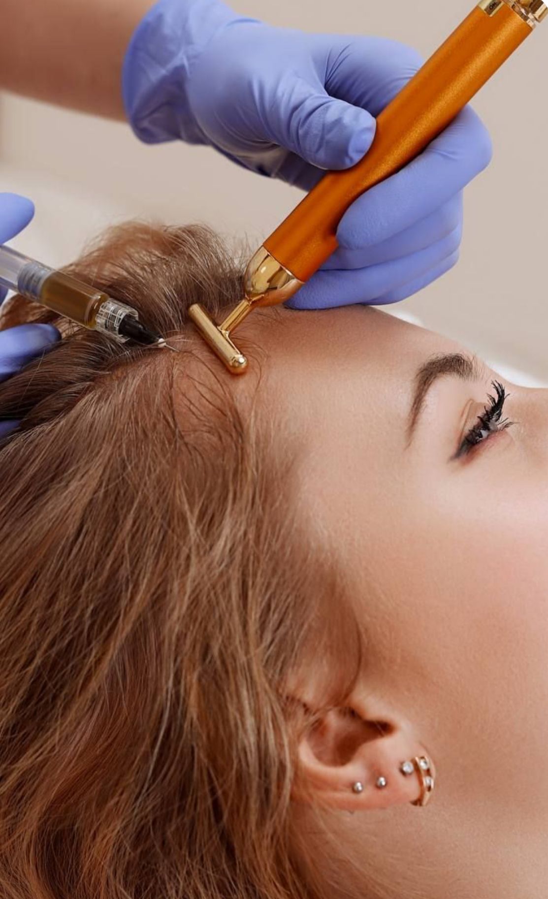 Hair Restoration
